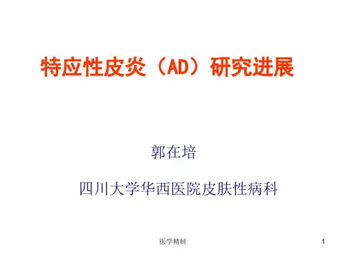 特应性皮炎(AD)研究进展(内容详细)