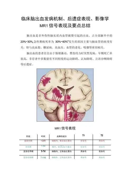 临床脑出血发病机制、后遗症表现、影像学MRI信号表现及要点总结
