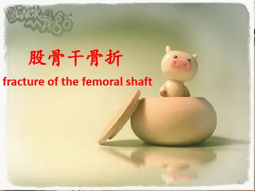 股骨干骨折护理PPT课件