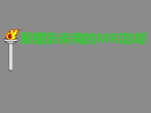 膝关节疾病的MRI诊断  PPT课件