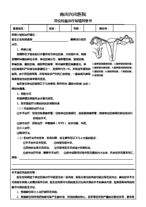 异位妊娠诊疗知情同意书