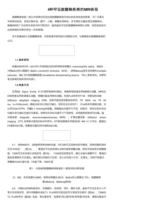 4种罕见脱髓鞘疾病的MRI表现