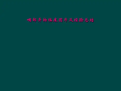 咽部异物临床图片及经验总结