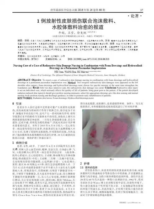 1例放射性皮肤损伤联合泡沫敷料、水胶体敷料治愈的报道