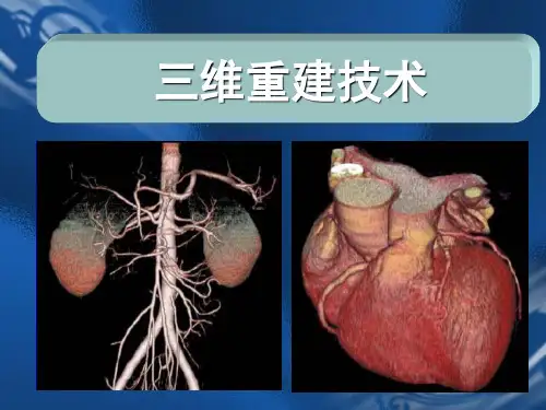 医学成像技术之三维重建技术讲义