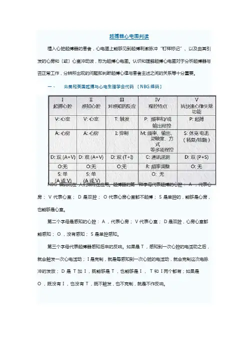 起搏器心电图判读