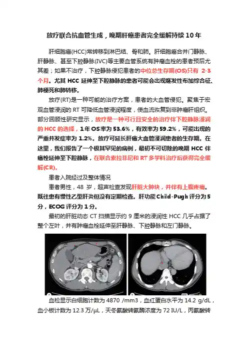 放疗联合抗血管生成，晚期肝癌患者完全缓解持续10年