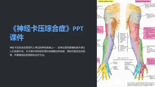 《神经卡压综合症》课件