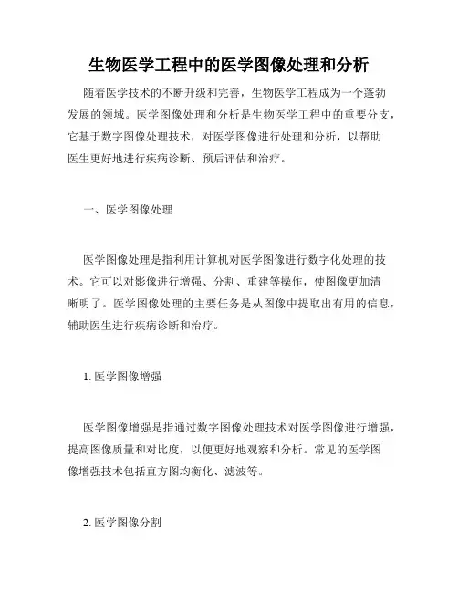 生物医学工程中的医学图像处理和分析