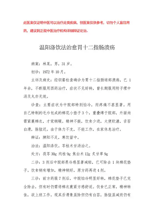 中医医案——胃十二指肠球部溃疡