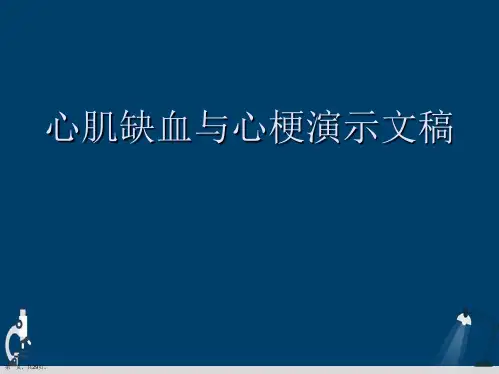 心肌缺血与心梗演示文稿