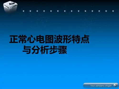 心电图学习PPT课件