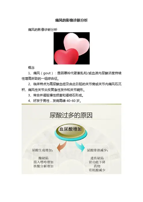 痛风的影像诊断分析