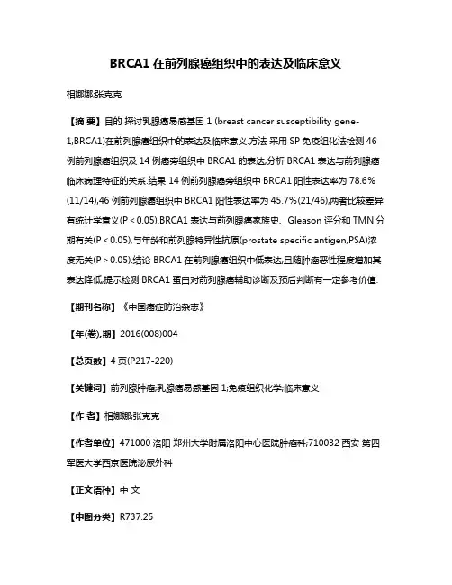 BRCA1在前列腺癌组织中的表达及临床意义