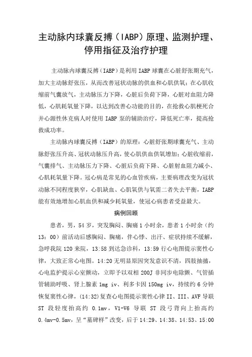 主动脉内球囊反搏(IABP)原理、监测护理、停用指征及治疗护理