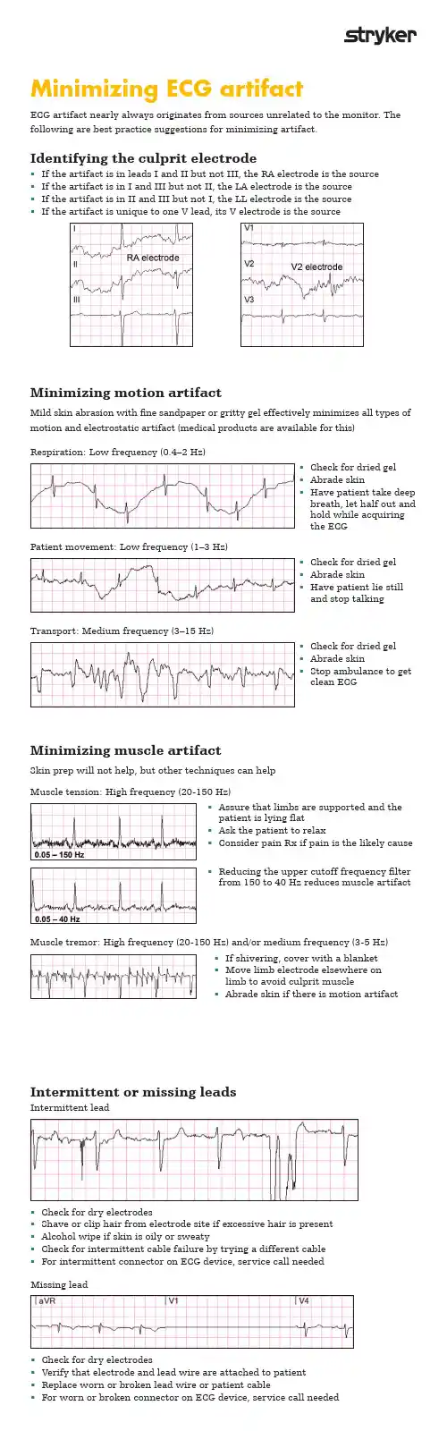 心电图（ECG）监测设备操作指南说明书