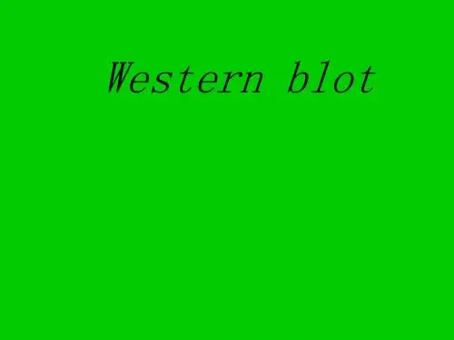 Western_blot_的由来_原理_步骤_帮你理解