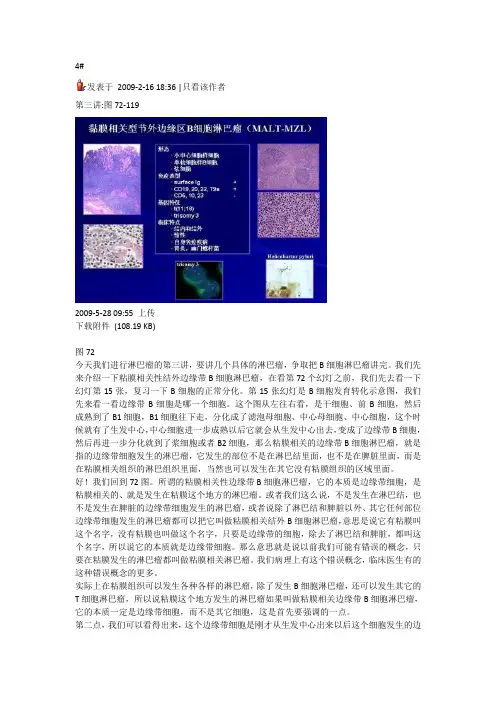 周小鸽讲淋巴瘤3
