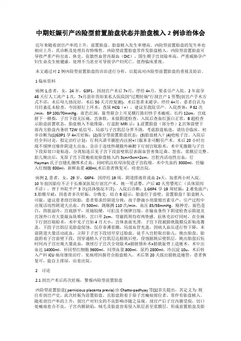 中期妊娠引产凶险型前置胎盘状态并胎盘植入2例诊治体会