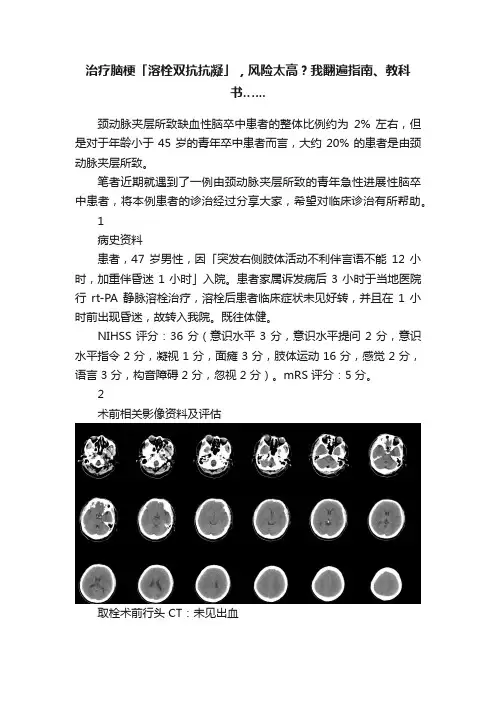 治疗脑梗「溶栓双抗抗凝」，风险太高？我翻遍指南、教科书.…..