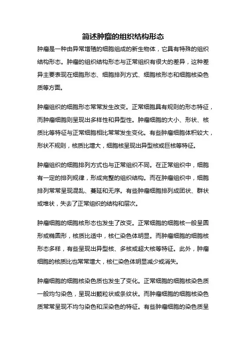 简述肿瘤的组织结构形态