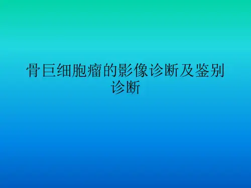 骨巨细胞瘤的影像表现与鉴别诊断 ppt课件