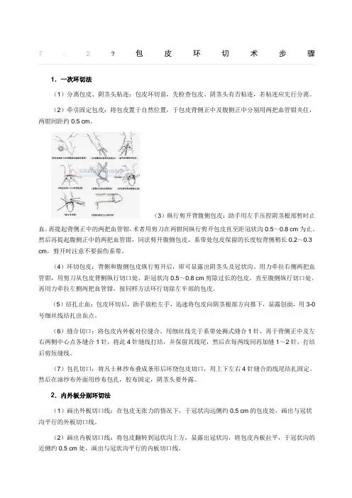 包皮环切术步骤