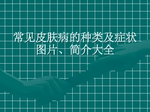 常见皮肤病的种类及症状图片、简介大全