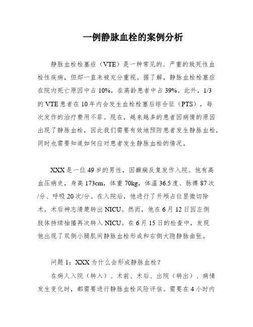 一例静脉血栓的案例分析