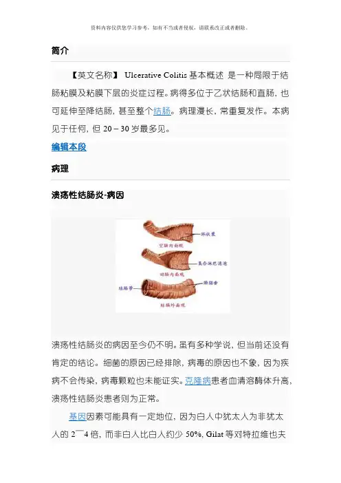 溃疡性结肠炎诊断标准模板