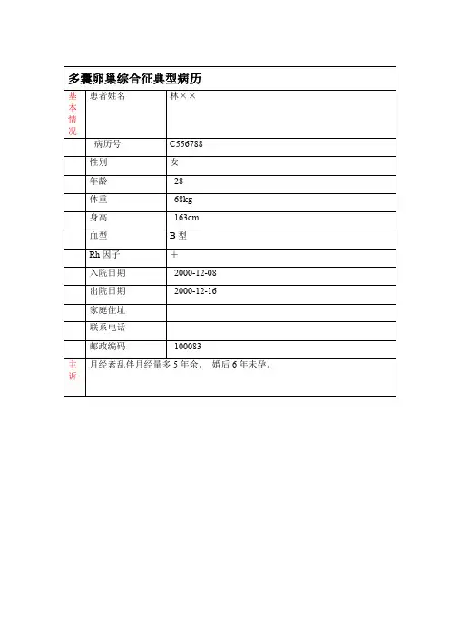 多囊卵巢综合征典型病历