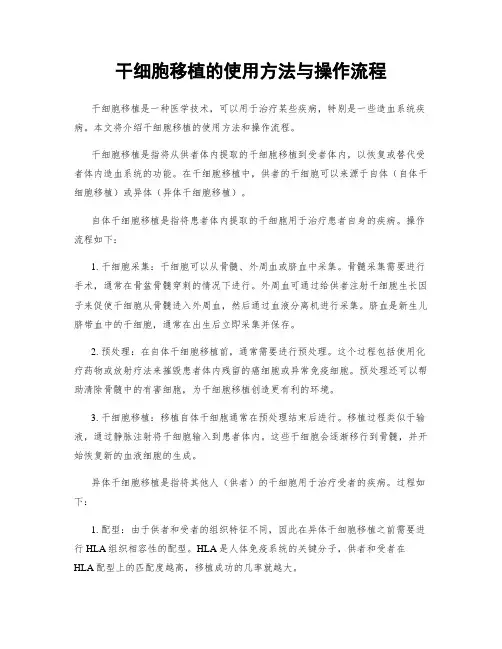 干细胞移植的使用方法与操作流程
