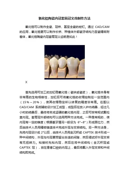 氧化锆陶瓷内冠套筒冠义齿制作方法