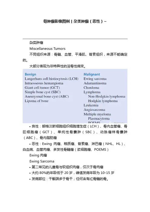 骨肿瘤影像图例丨杂类肿瘤（恶性）~