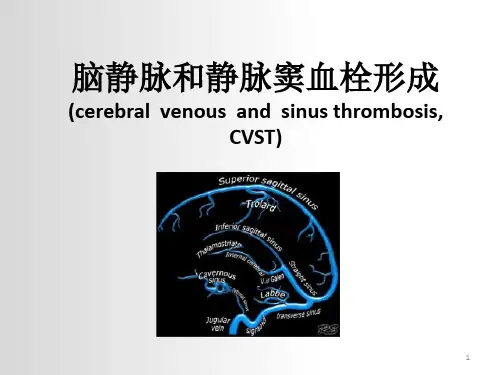 脑静脉和静脉窦血栓形成PPT课件