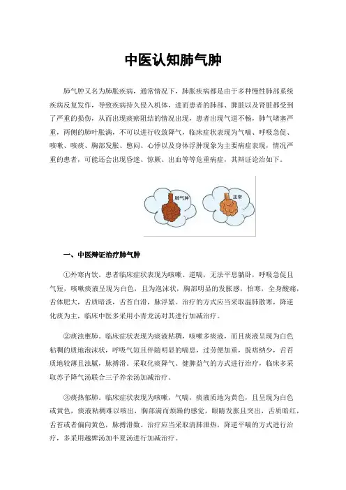 中医认知肺气肿