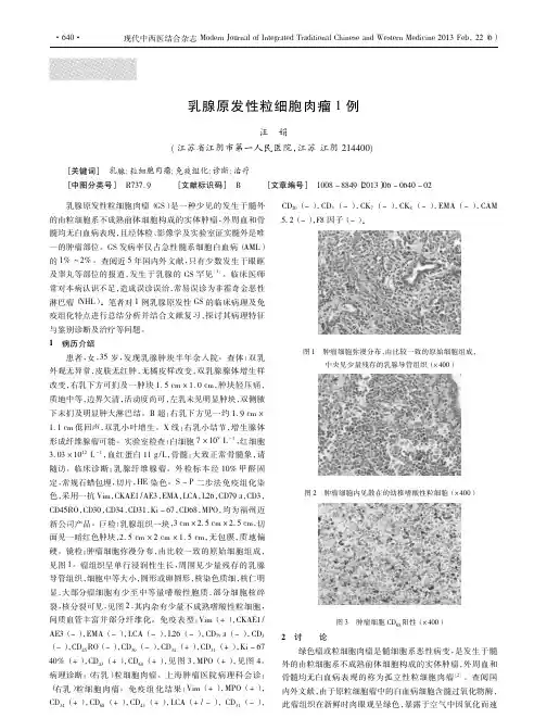 乳腺原发性粒细胞肉瘤1例汪娟