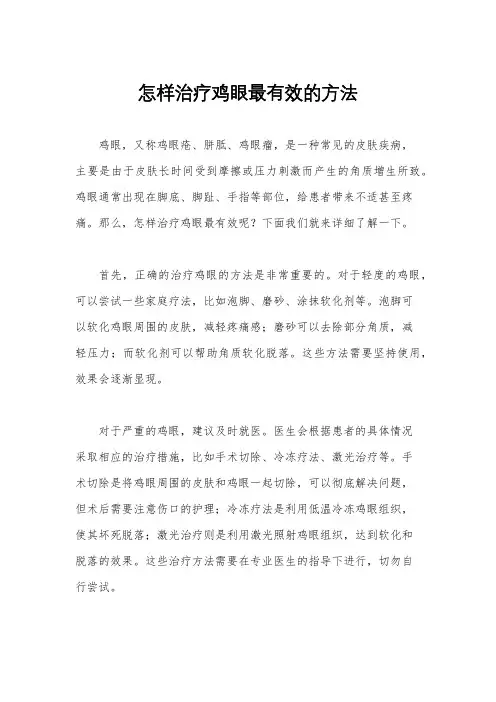 怎样治疗鸡眼最有效的方法