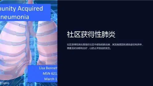 《社区获得性肺炎》课件