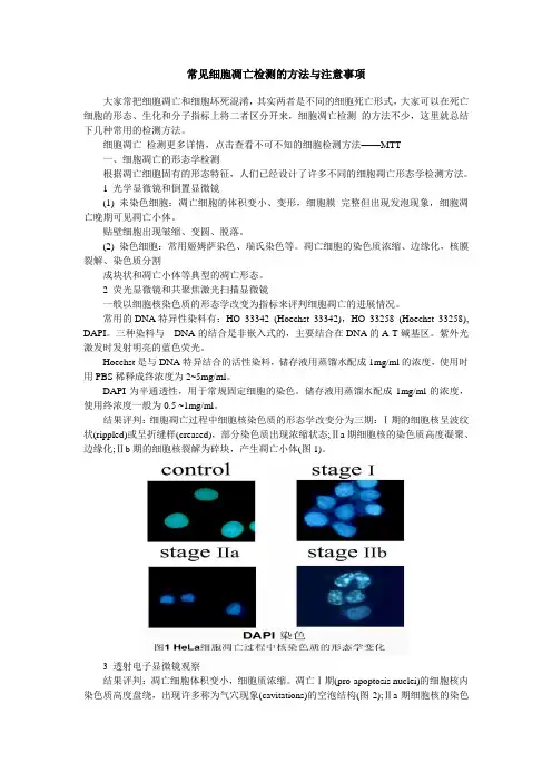 常见细胞凋亡检测的方法与注意事项