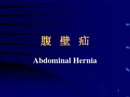 腹壁疝_精品文档