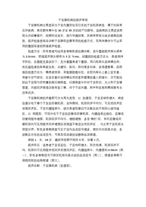 子宫腺肌病的超声表现