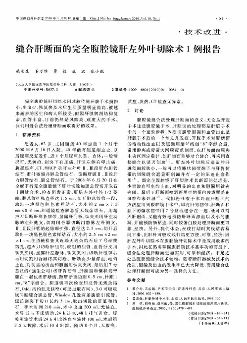 缝合肝断面的完全腹腔镜肝左外叶切除术1例报告