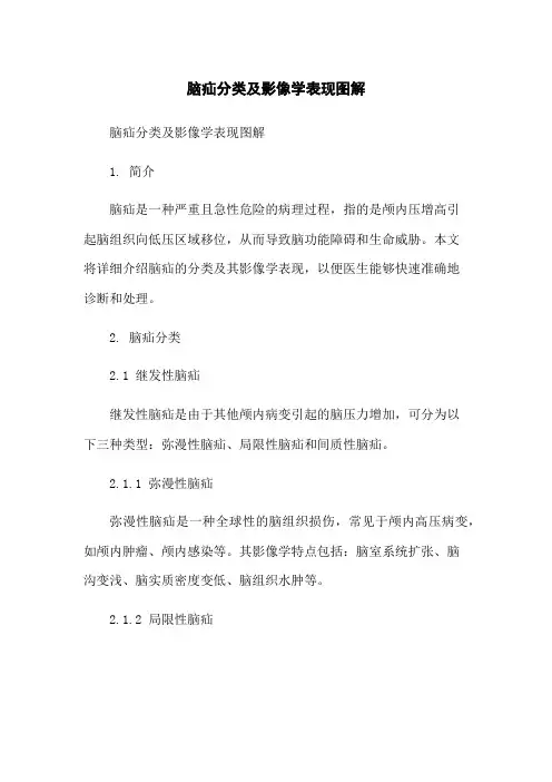 脑疝分类及影像学表现图解