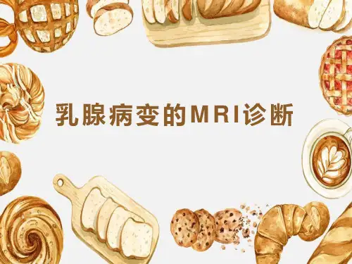 乳腺病变的MRI诊断
