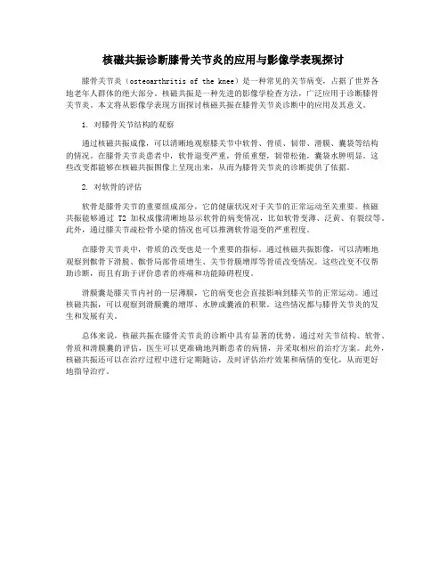 核磁共振诊断膝骨关节炎的应用与影像学表现探讨