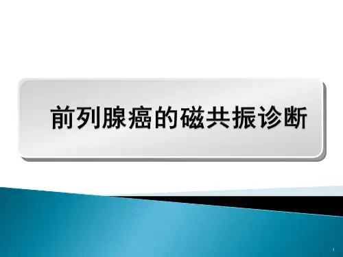 磁共振前列腺癌ppt课件