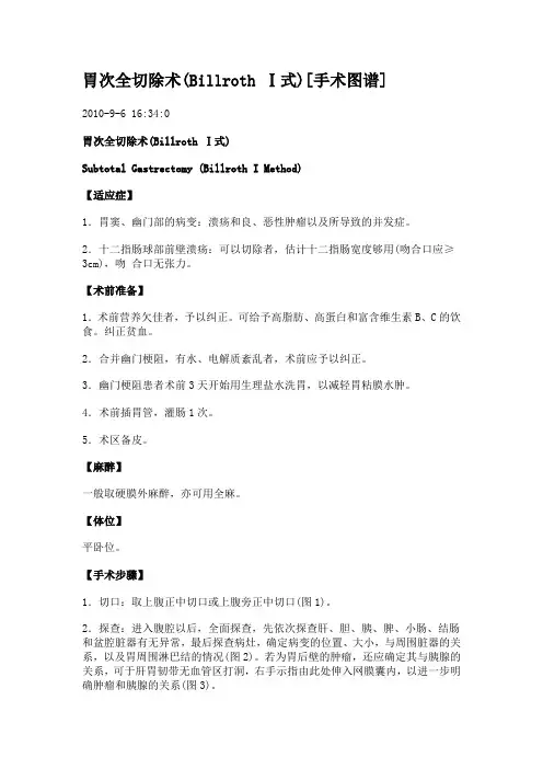 胃次全切除术(Billroth Ⅰ式)[手术图谱]