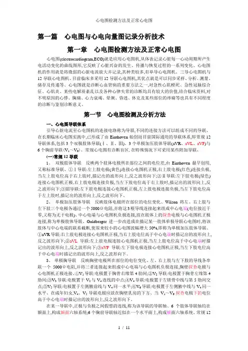 心电图检测方法及正常心电图