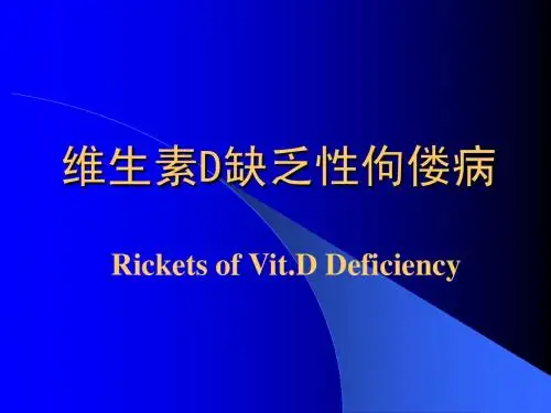 佝偻病课件01